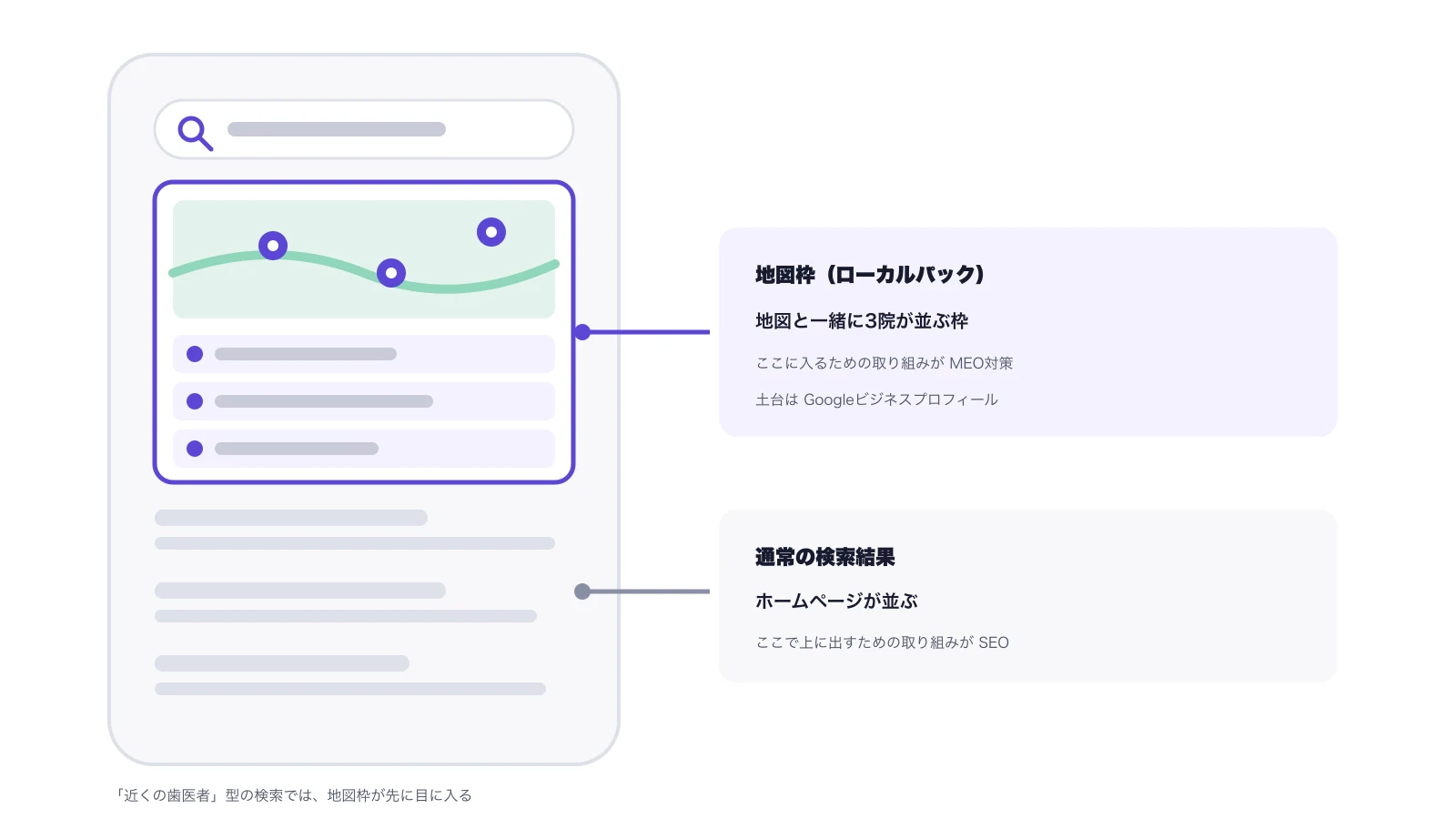 スマートフォンの検索結果の模式図。上部に地図と3院が並ぶ地図枠（ローカルパック）、その下に通常の検索結果。地図枠に入る取り組みがMEO対策、通常結果で上に出す取り組みがSEO